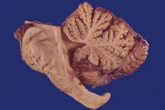 Мозжечок состоит из 3 частей